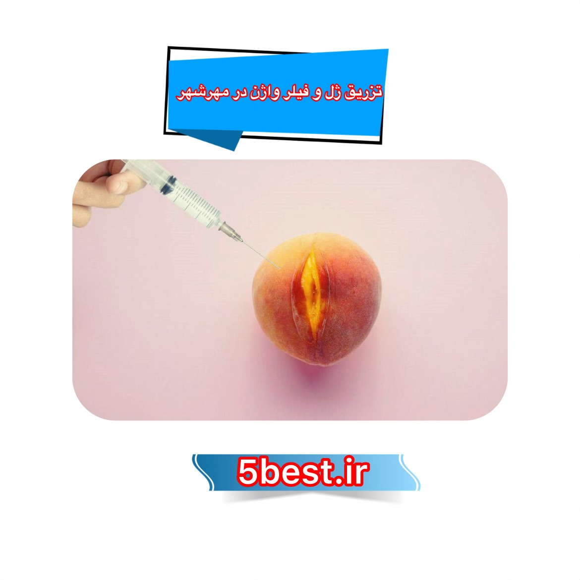 تزریق ژل و فیلر واژن در مهرشهر