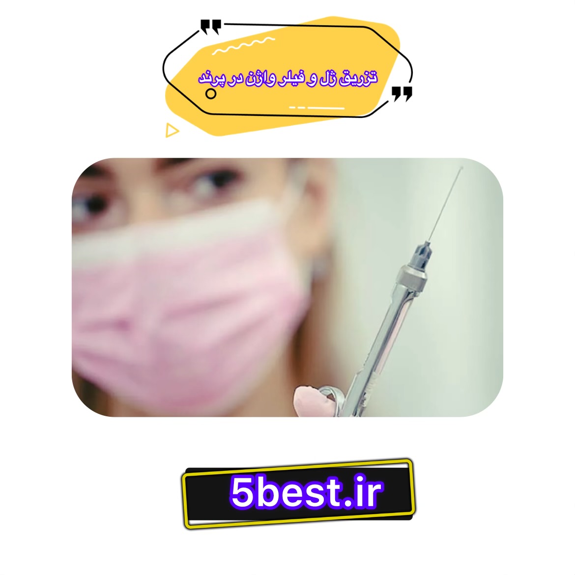 تزریق ژل و فیلر واژن در پرند