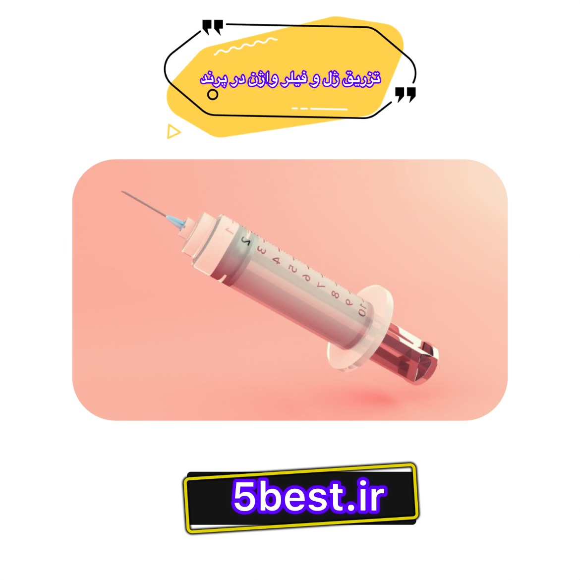 تزریق ژل و فیلر واژن در پرند