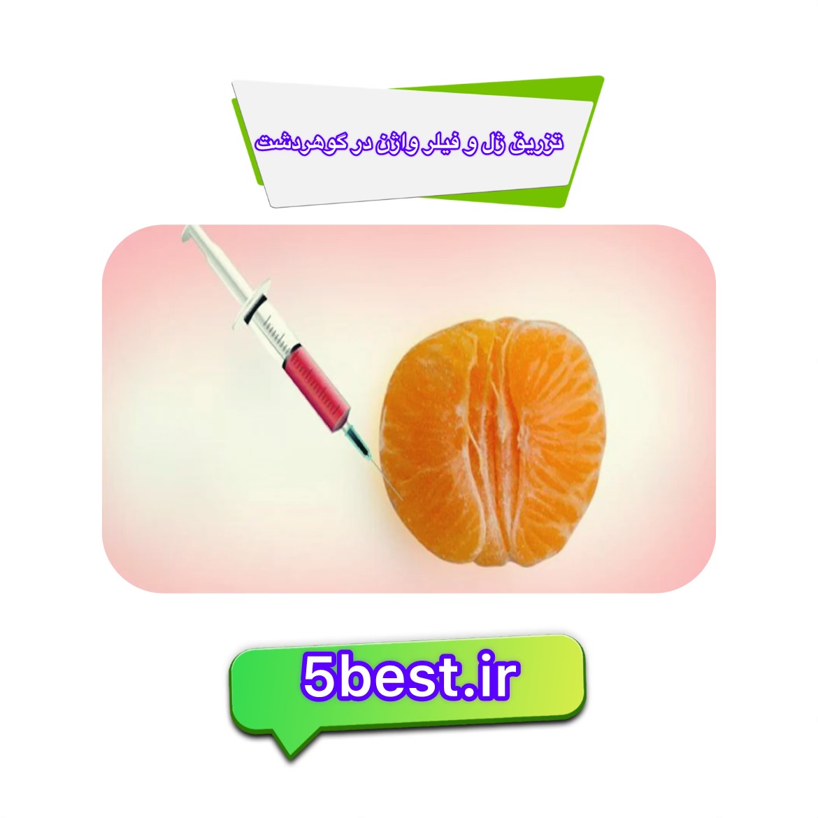  تزریق ژل و فیلر واژن در گوهردشت