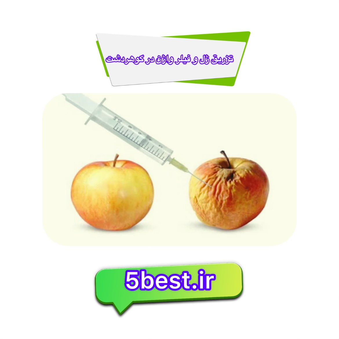  تزریق ژل و فیلر واژن در گوهردشت