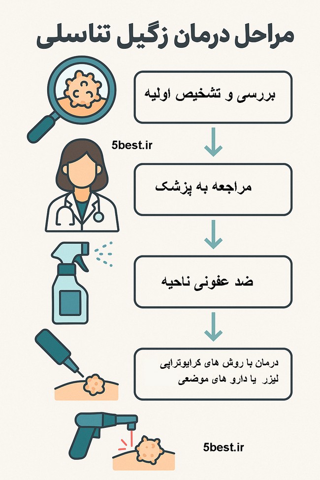 مراحل درمان زگیل تناسلی