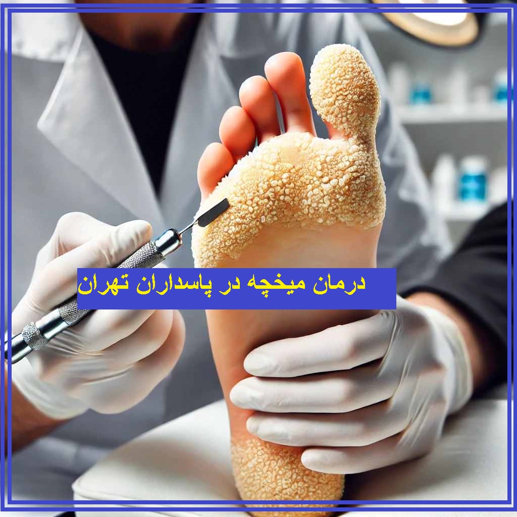 درمان میخچه در پاسداران