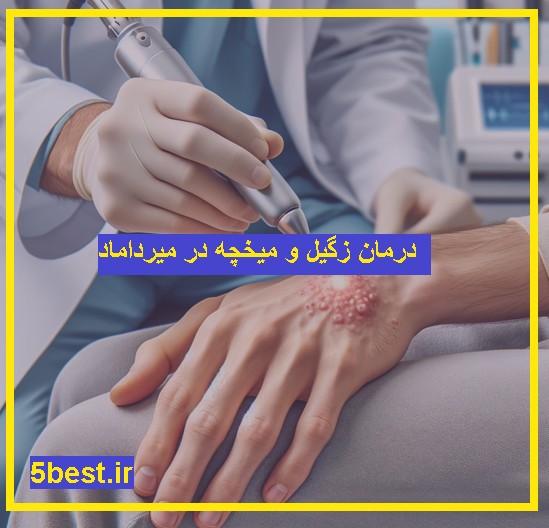 مراکز درمان درمان زگیل میرداماد