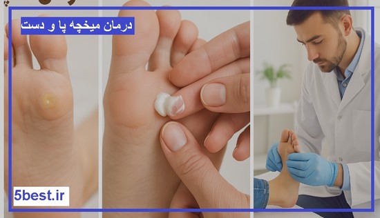 درمان میخچه پا
