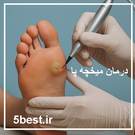 درمان میخچه پا در قلهک