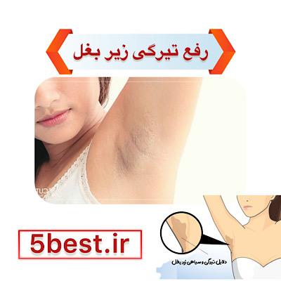 رفع تیرگی زیر بغل