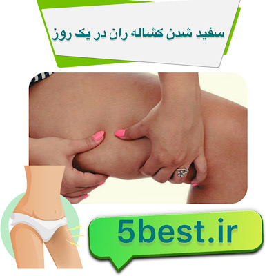 سفید شدن کشاله ران در یک روز