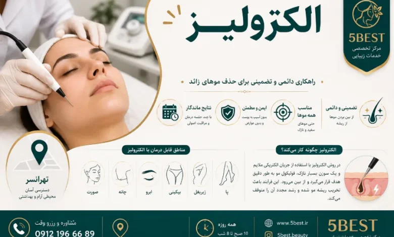 الکترولیز مرزداران