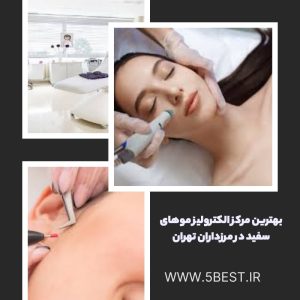 بهترین مرکز الکترولیز موهای سفید در مرزداران تهران