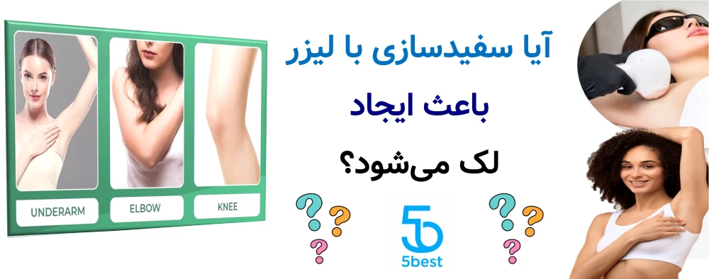 آیا سفیدسازی با لیزر باعث ایجاد لک میشود؟