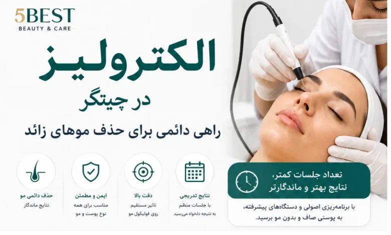 الکترولیز مو زائد در چیتگر