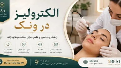 الکترولیز ونک