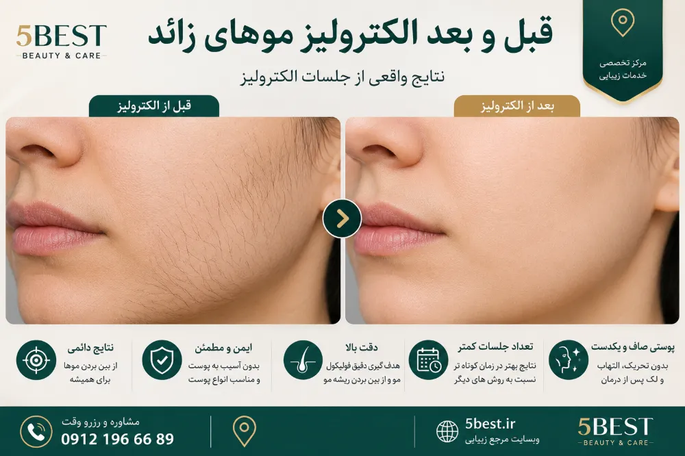 انتظارات واقعبینانه از نتایج الکترولیز