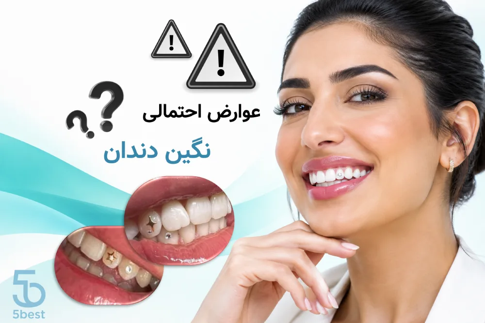 عوارض احتمالی نگین دندان