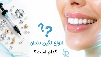 انواع نگین دندان کدام است؟
