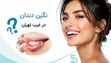 نگین دندان در غرب تهران