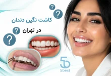 کاشت نگین دندان در تهران