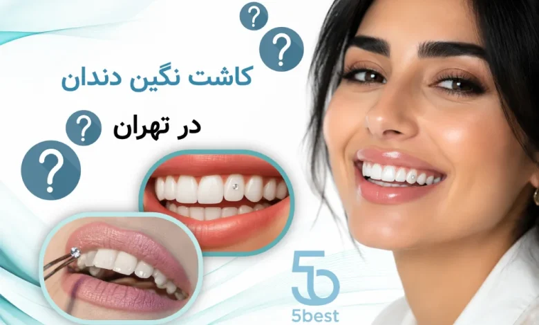 کاشت نگین دندان در تهران