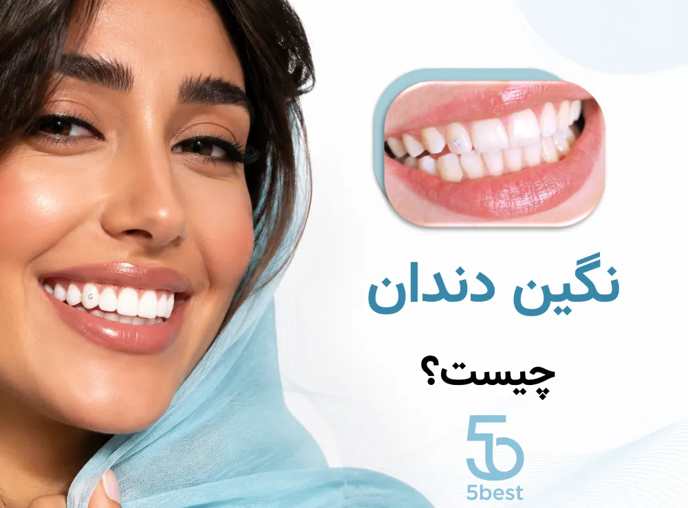 نگین دندان چیست؟