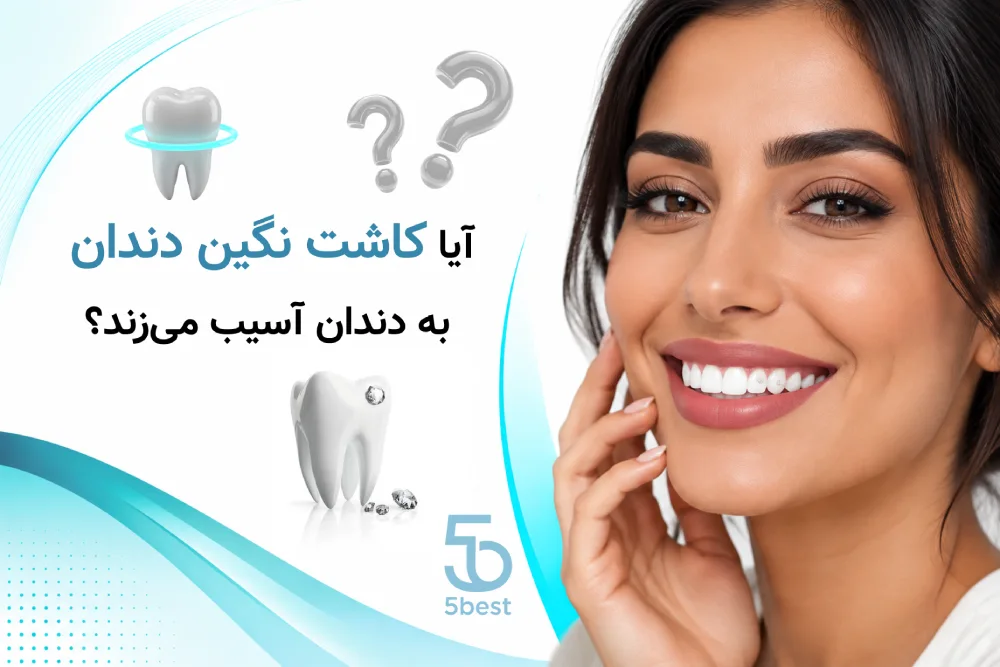 آیا کاشت نگین دندان به دندان آسیب می‌زند؟