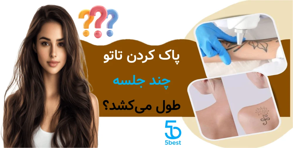 پاک کردن تاتو چند جلسه طول میکشد؟