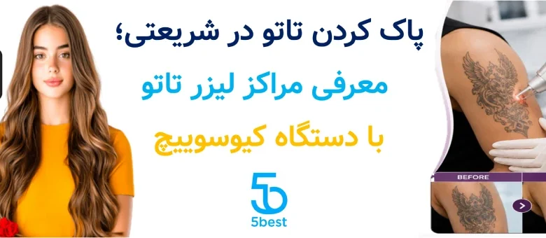 پاک کردن تاتو در شریعتی ؛ معرفی مراکز لیزر تاتو با دستگاه کیوسوییچ