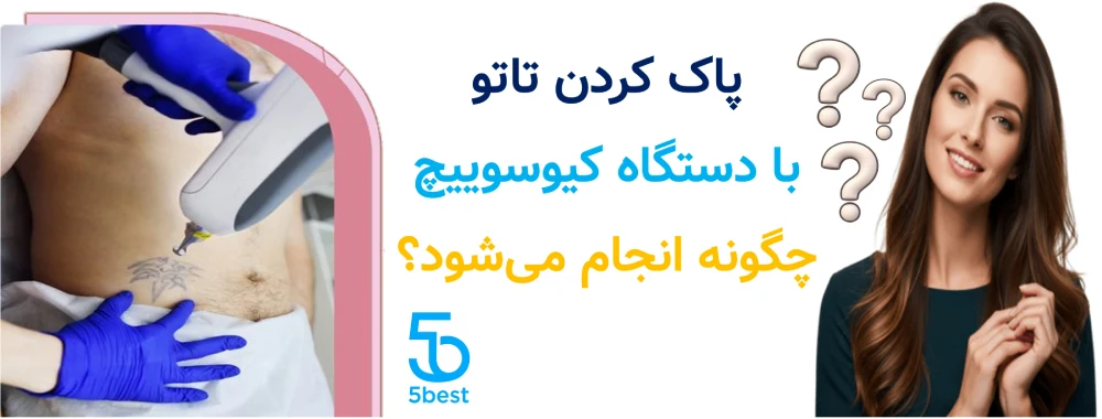 پاک کردن تاتو با دستگاه کیوسوییچ چگونه انجام می‌شود؟