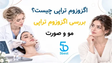 اگزوزوم تراپی چیست؟ بررسی اگزوزوم تراپی مو و صورت